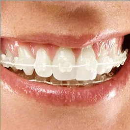 Six Month Smiles - Cork Ireland